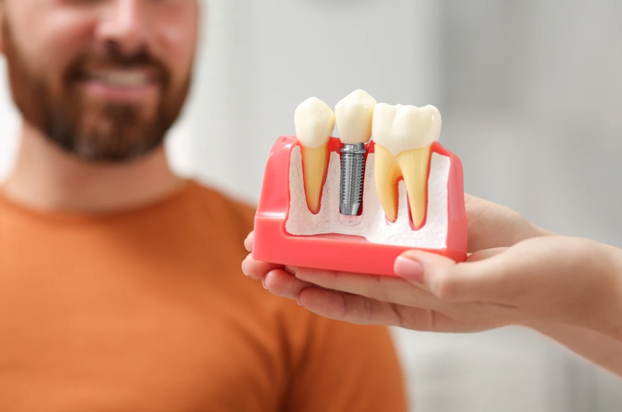 implante dentario na espaco sorriso dentista em itaguai implante dentario na espaco sorriso dentista em itaguai