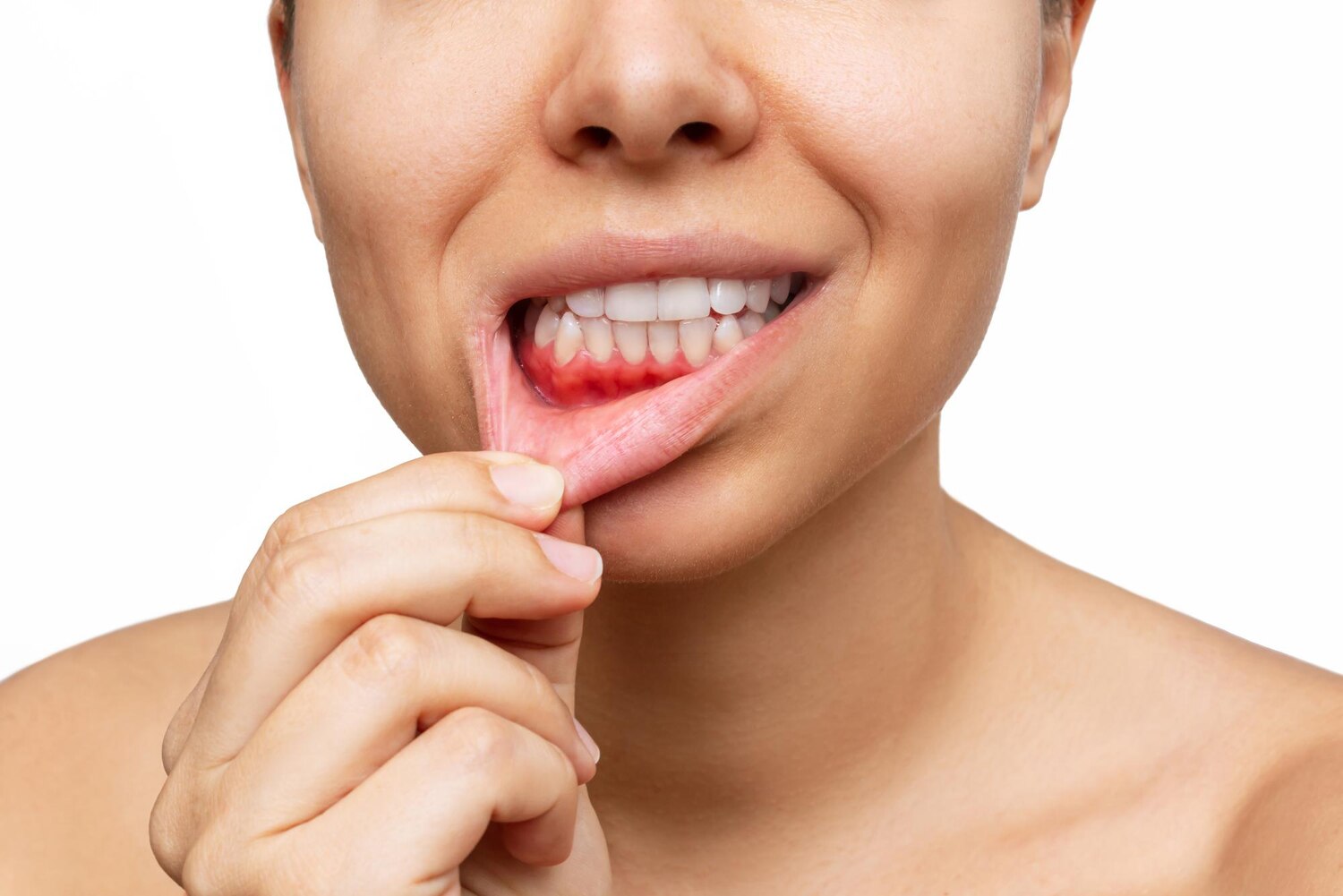 gum inflammation cropped shot young woman shows red bleeding gums pulling lip 407348 2212 gum inflammation cropped shot young woman shows red bleeding gums pulling lip 407348 2212