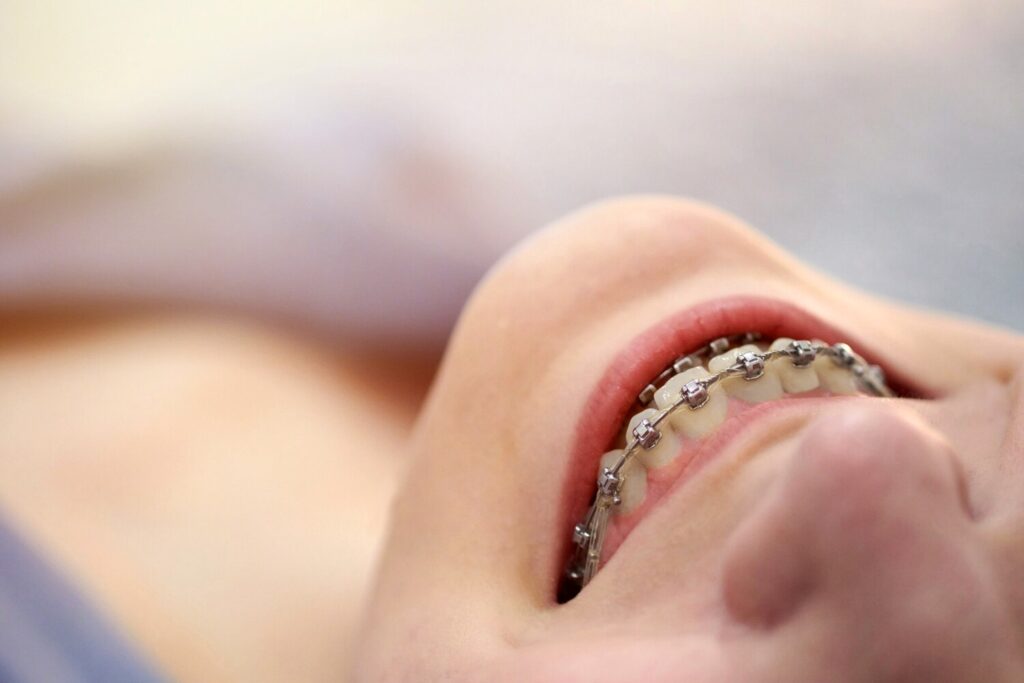 smiling young woman with brackets teeth close up 77829 4031 smiling young woman with brackets teeth close up 77829 4031