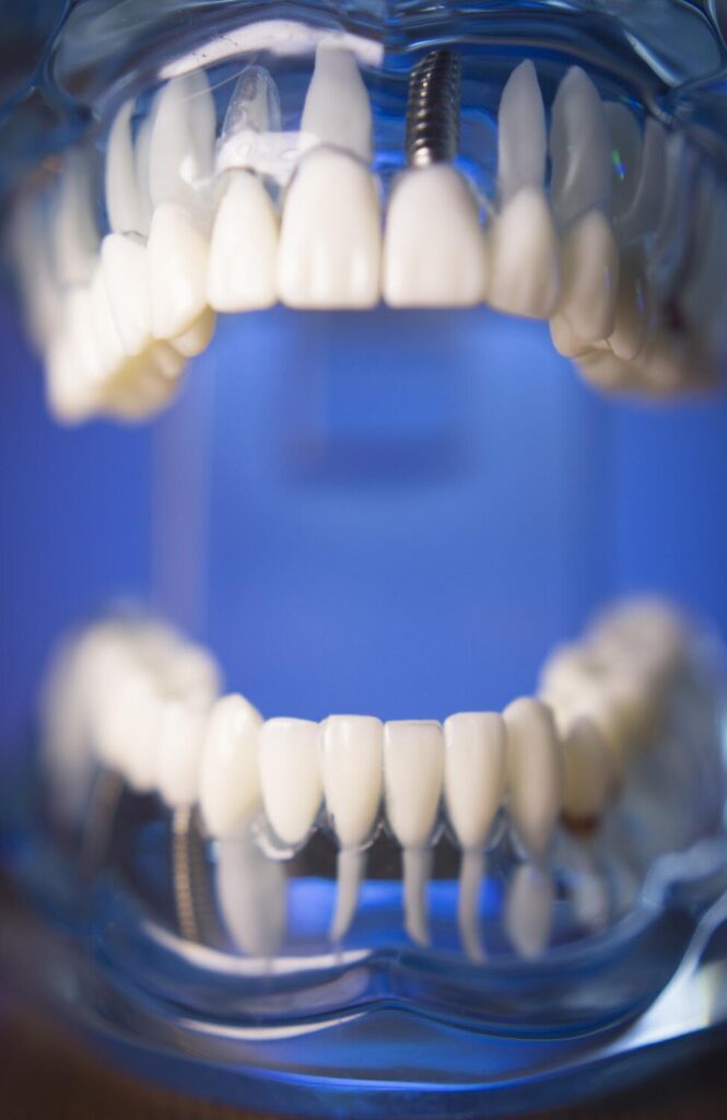 close up dentures against blue background 1048944 6473425 close up dentures against blue background 1048944 6473425